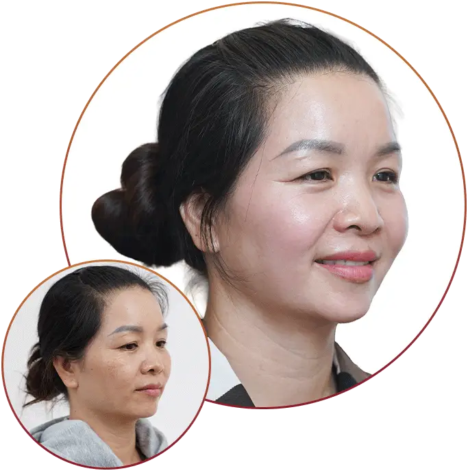 Phòng Khám Da Liễu Tuyết Sương – Chuyên Điều Trị Nám Da