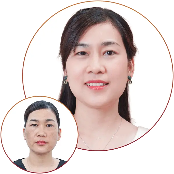 Phòng Khám Da Liễu Tuyết Sương – Chuyên Điều Trị Nám Da