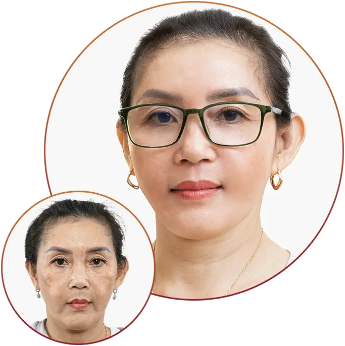 Phòng Khám Da Liễu Tuyết Sương – Chuyên Điều Trị Nám Da