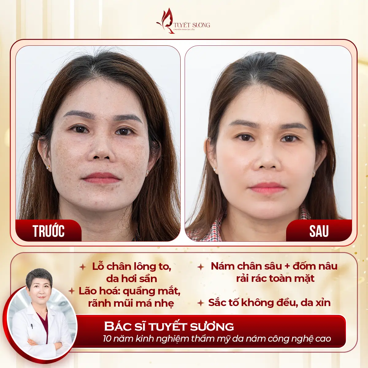 Video – Hình Ảnh Kết Quả Khách Hàng Điều Trị Nám Da