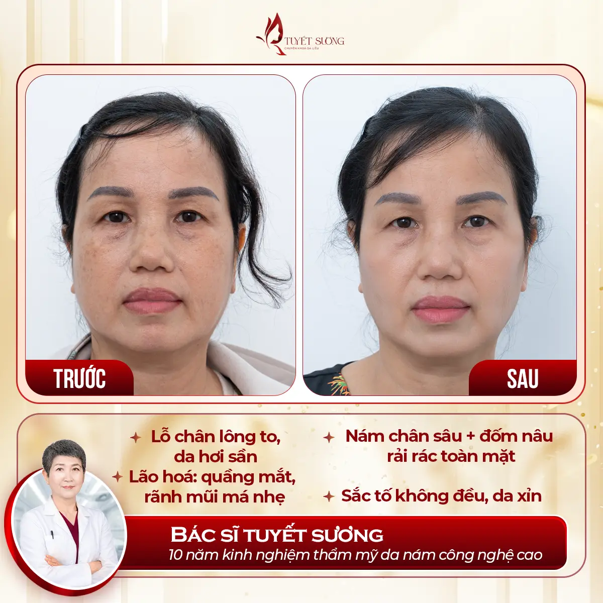Video – Hình Ảnh Kết Quả Khách Hàng Điều Trị Nám Da