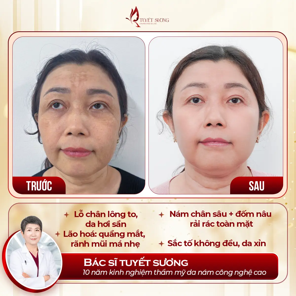 Video – Hình Ảnh Kết Quả Khách Hàng Điều Trị Nám Da