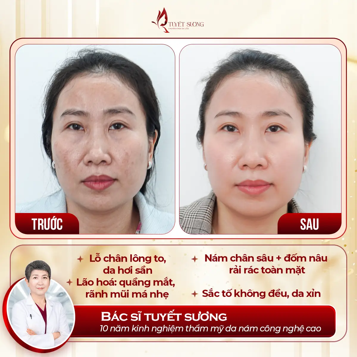 Video – Hình Ảnh Kết Quả Khách Hàng Điều Trị Nám Da
