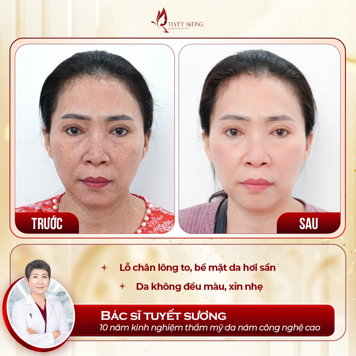 Video – Hình Ảnh Kết Quả Khách Hàng Điều Trị Nám Da