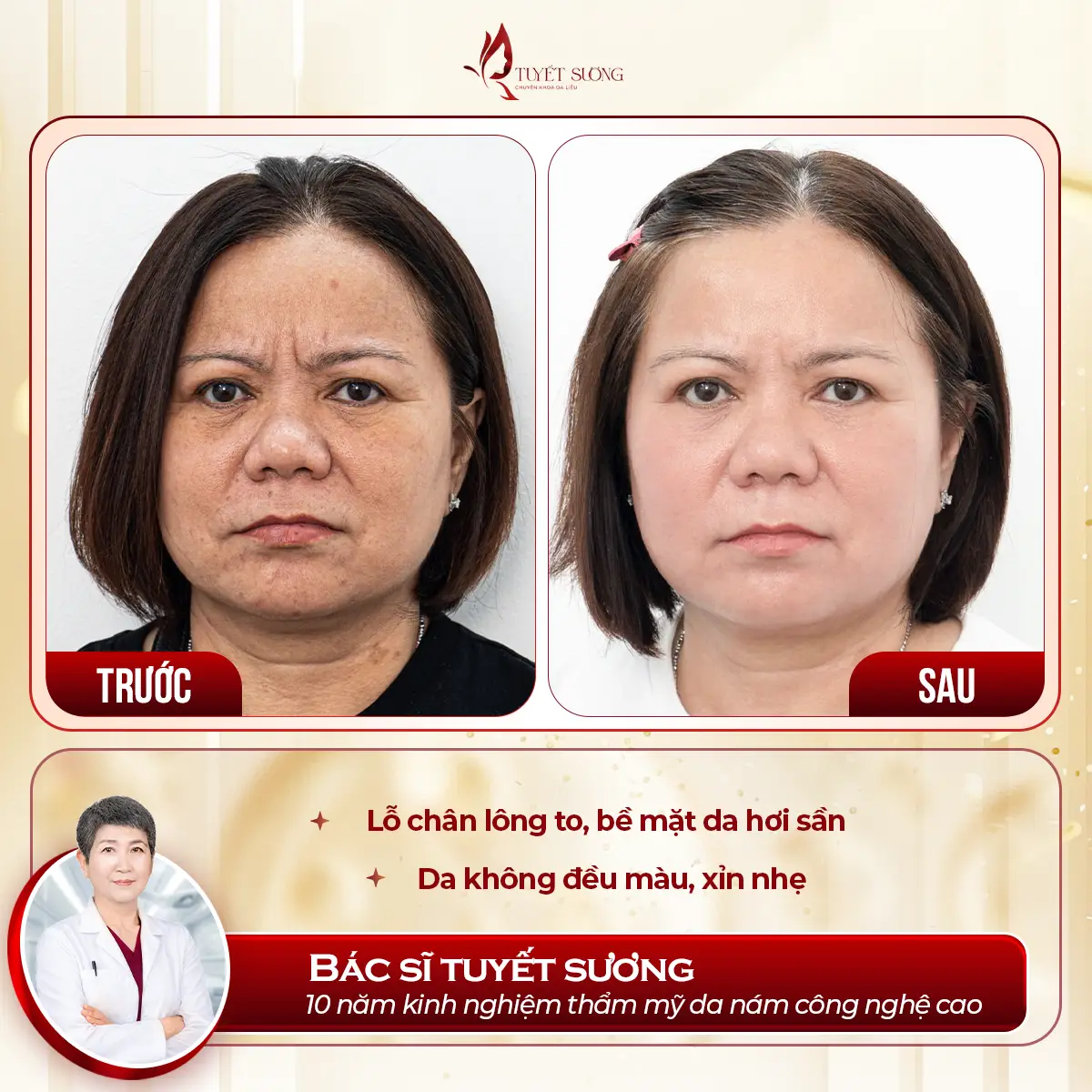 Video – Hình Ảnh Kết Quả Khách Hàng Điều Trị Nám Da