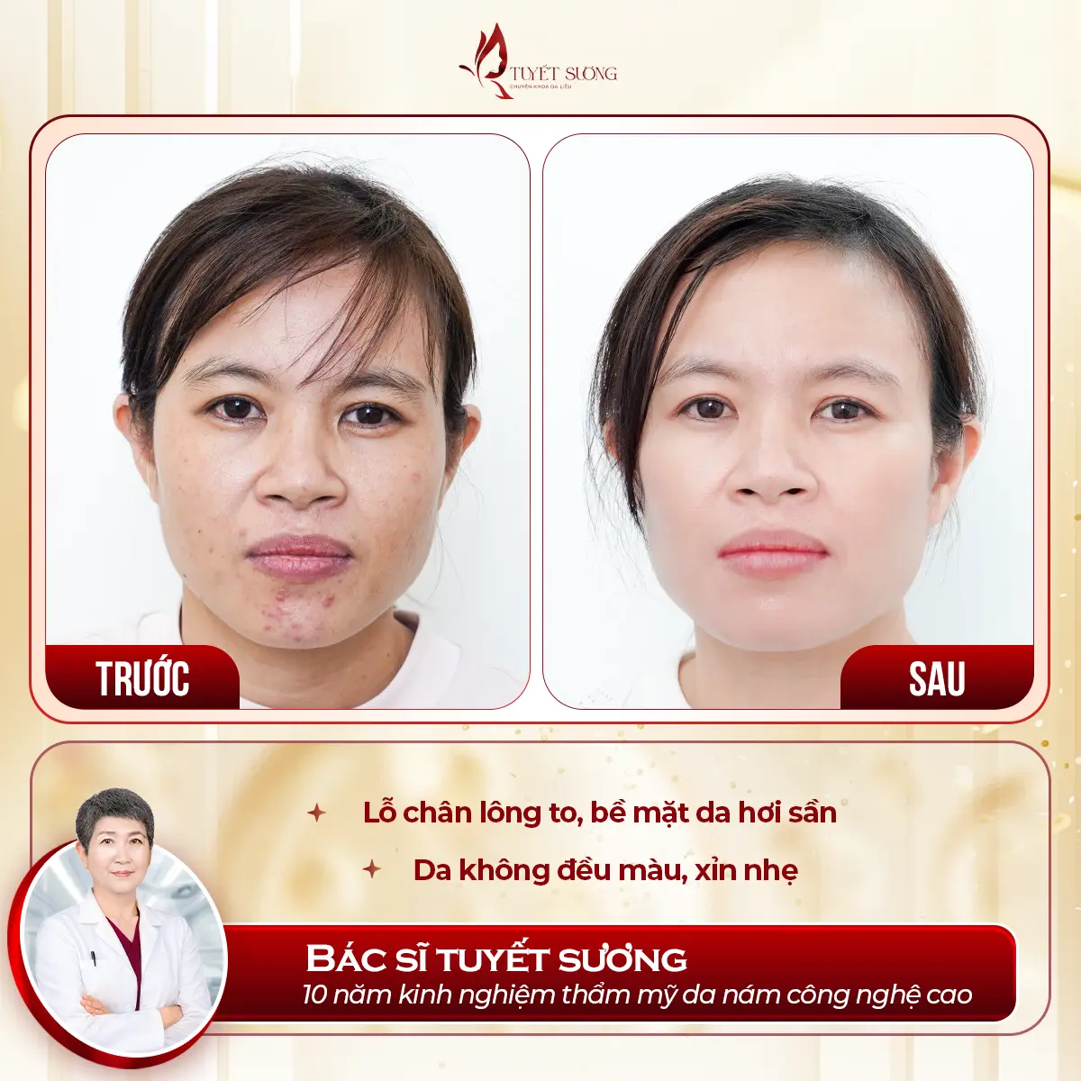 Video – Hình Ảnh Kết Quả Khách Hàng Điều Trị Nám Da