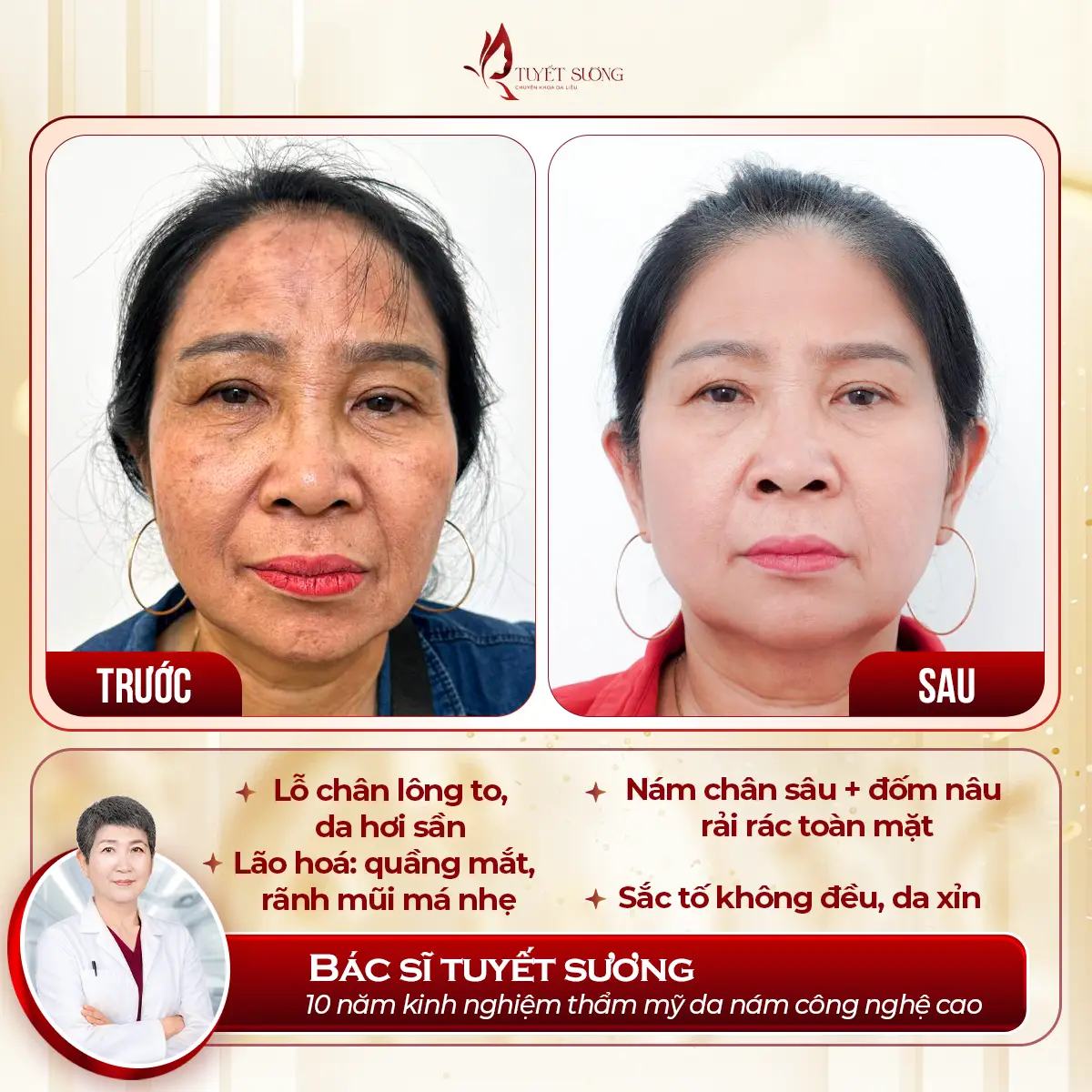 Video – Hình Ảnh Kết Quả Khách Hàng Điều Trị Nám Da
