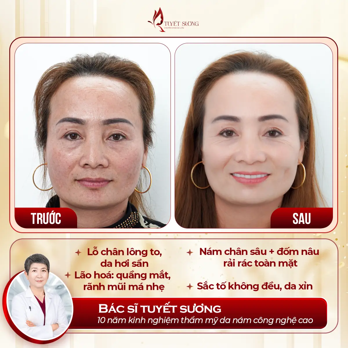 Video – Hình Ảnh Kết Quả Khách Hàng Điều Trị Nám Da