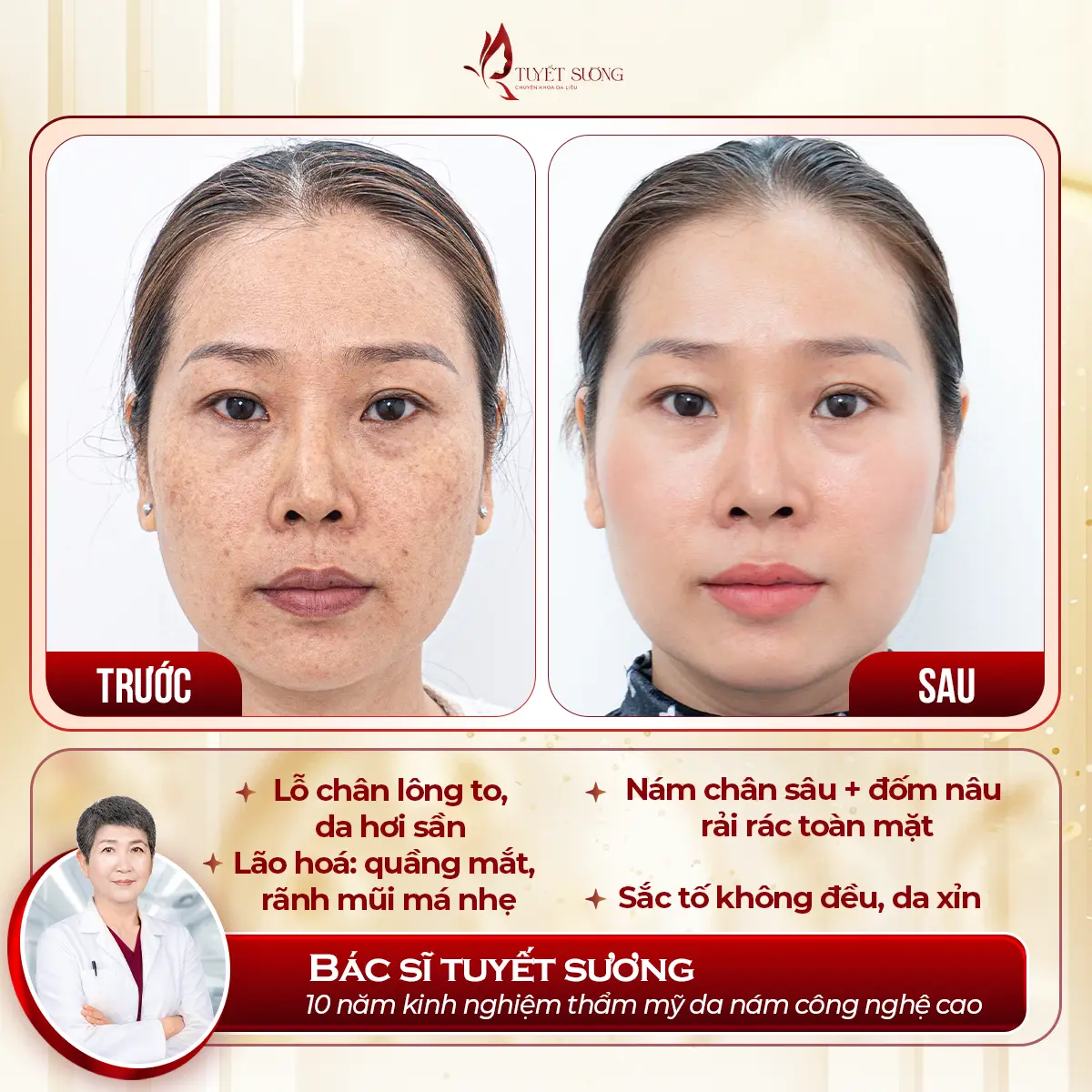 Video – Hình Ảnh Kết Quả Khách Hàng Điều Trị Nám Da