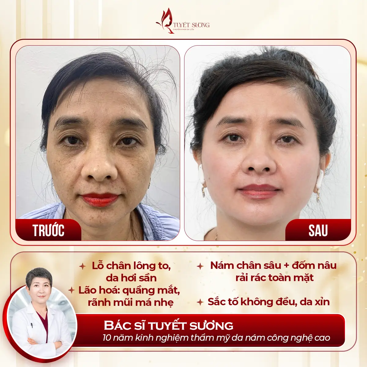Video – Hình Ảnh Kết Quả Khách Hàng Điều Trị Nám Da