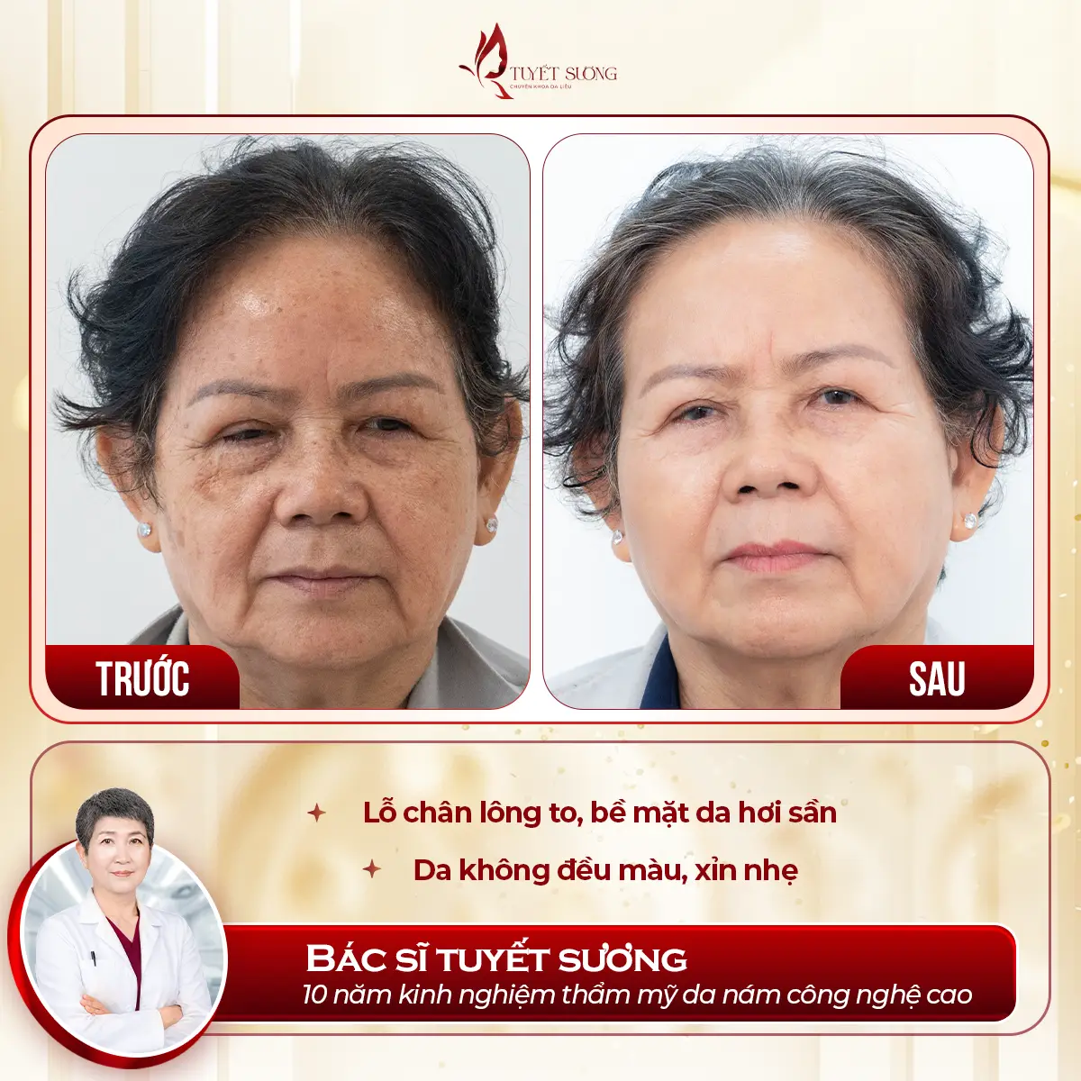 Video – Hình Ảnh Kết Quả Khách Hàng Điều Trị Nám Da